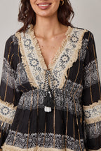 Woman wearing a black and white patterned dress with lace details.