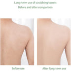 [UK Warehouse] Body Cleaning Back Scrubber Exfoliating Bath Towel Washcloth Shower Scrubber