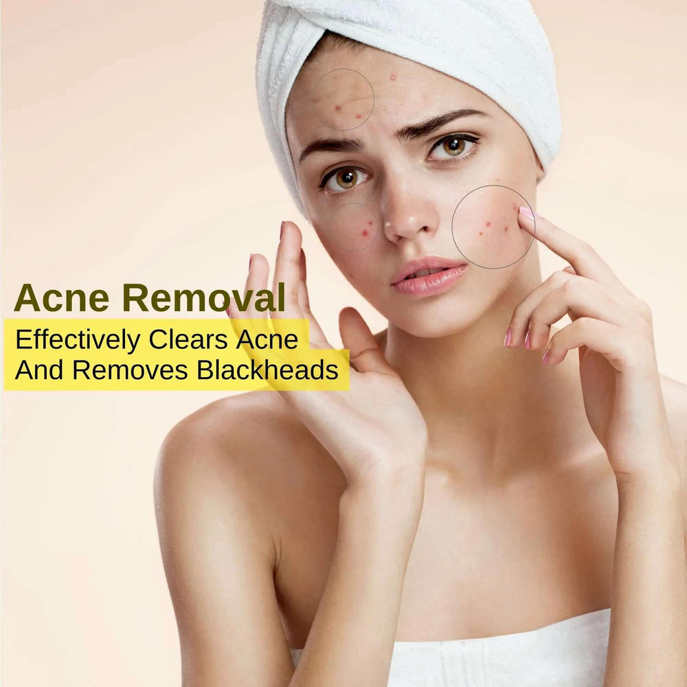 Woman with acne showing skin concerns demonstrating use of 24K gold collagen face mask by Ammuri Skincare