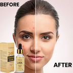 Ammuri Skincare 24K gold serum for dark circles with before and after results on model's skin