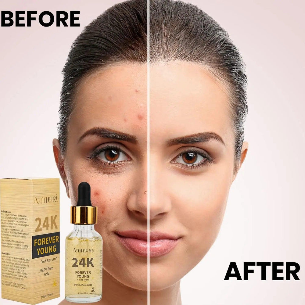 Ammuri Skincare 24K gold serum for dark circles with before and after results on model's skin