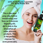 AMMURI Anti Acne Facial Cleanser - Clear Skin Magic for Acne-Prone Complexions - Facial Cleanser - British D'sire