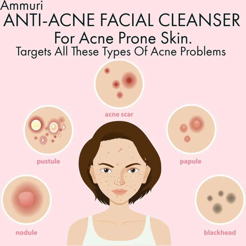 AMMURI Anti Acne Facial Cleanser - Clear Skin Magic for Acne - Prone Complexions - Facial Cleanser - British D'sire