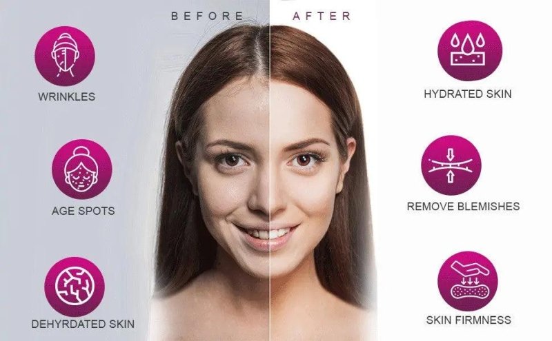 Ammuri Botox Serum Age Reverse Made in UK - AMMURI AGE REVERSE AGIRELINE PEPTIDE, MATRIXYL 3000 Anti Ageing Serum - British D'sire