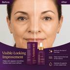 Ammuri Botox Serum Age Reverse Made in UK - AMMURI AGE REVERSE AGIRELINE PEPTIDE, MATRIXYL 3000 Anti Ageing Serum - British D'sire