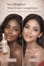 Ammuri Exosome Booster Serum – Brightening & Hydration Booster with Kojic Acid, Vitamin C & Alpha Arbutin | Fades Dark Spots, Evens Skin Tone & Boosts Radiance | For Face & Body – 30ml - WHITENING Lightening Serum - British D'sire