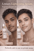 Ammuri Exosome Booster Serum – Brightening & Hydration Booster with Kojic Acid, Vitamin C & Alpha Arbutin | Fades Dark Spots, Evens Skin Tone & Boosts Radiance | For Face & Body – 30ml - WHITENING Lightening Serum - British D'sire