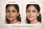 Ammuri Exosome Booster Serum – Brightening & Hydration Booster with Kojic Acid, Vitamin C & Alpha Arbutin | Fades Dark Spots, Evens Skin Tone & Boosts Radiance | For Face & Body – 30ml - WHITENING Lightening Serum - British D'sire