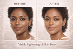 Ammuri Exosome Booster Serum – Brightening & Hydration Booster with Kojic Acid, Vitamin C & Alpha Arbutin | Fades Dark Spots, Evens Skin Tone & Boosts Radiance | For Face & Body – 30ml - WHITENING Lightening Serum - British D'sire