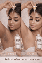 Ammuri Exosome Booster Serum – Brightening & Hydration Booster with Kojic Acid, Vitamin C & Alpha Arbutin | Fades Dark Spots, Evens Skin Tone & Boosts Radiance | For Face & Body – 30ml - WHITENING Lightening Serum - British D'sire