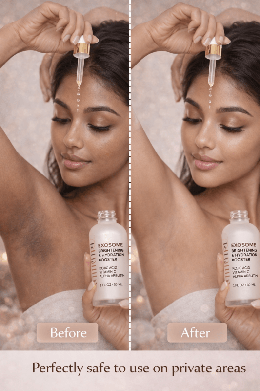Ammuri Exosome Booster Serum – Brightening & Hydration Booster with Kojic Acid, Vitamin C & Alpha Arbutin | Fades Dark Spots, Evens Skin Tone & Boosts Radiance | For Face & Body – 30ml - WHITENING Lightening Serum - British D'sire