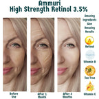 Ammuri High Strength Retinol 3.5% Serum Before and After Results Showcasing Skin Improvement