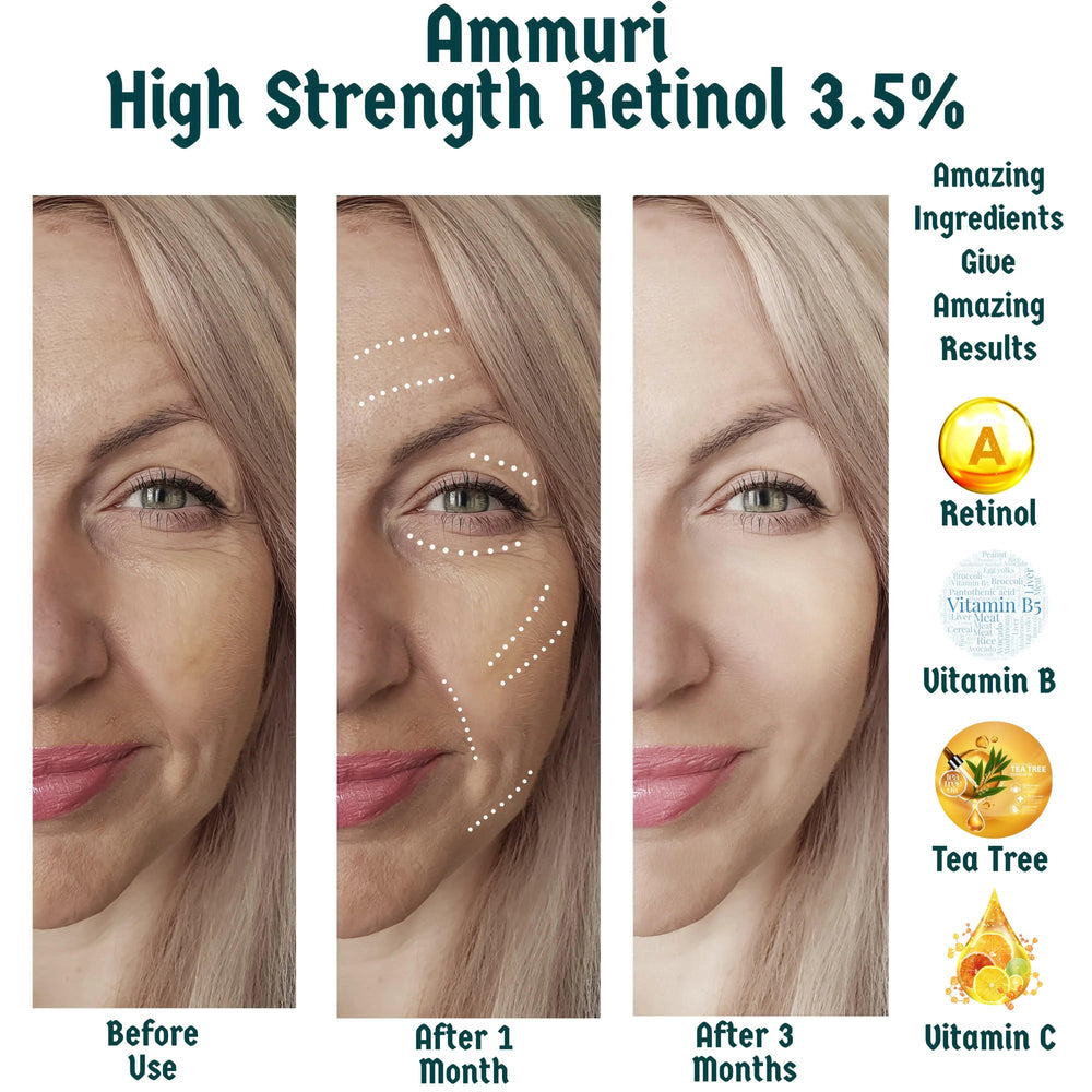 Ammuri High Strength Retinol 3.5% Serum Before and After Results Showcasing Skin Improvement