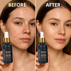 Ammuri Retinol 2.5% Rejuvenation Serum for Wrinkles, Dark Spots & Hydration 30ml - British D'sire
