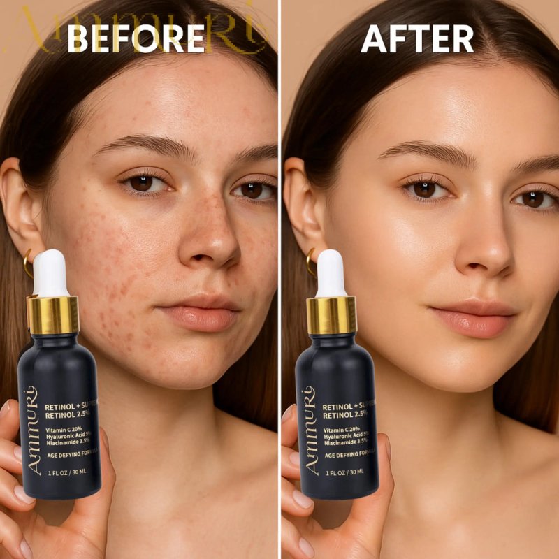 Ammuri Retinol 2.5% Rejuvenation Serum for Wrinkles, Dark Spots & Hydration 30ml - British D'sire