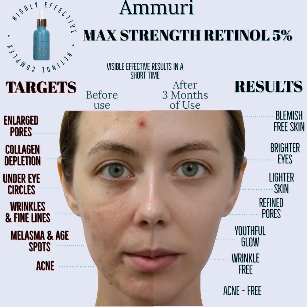 Ammuri retinol 5 serum before and after results showcasing improved skin texture and reduced blemishes