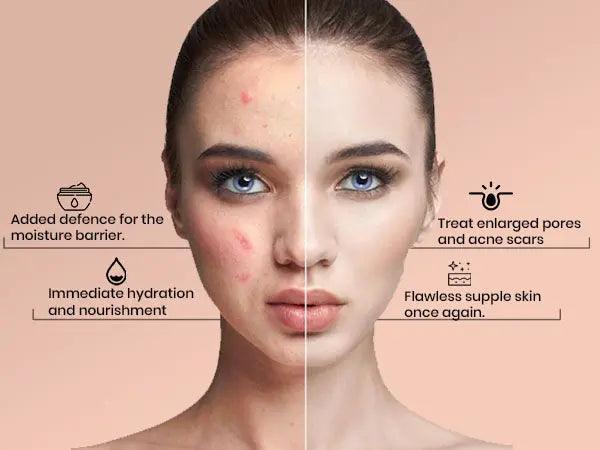 Ammuri Unlock Timeless Beauty with Ammuri Retinol Q10 Face Cream+ Advance Retinol 2.5% - ADVANCE RETINOL 2.5% + Q10, DAY & NIGHT CREAM - British D'sire