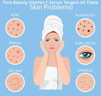 Ammuri Vitamin C Serum - Powerful Anti - Aging Skincare Seal - Vitamin C Face Serum for Anti - Ageing - British D'sire