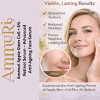 Ammuri’s 5% High Strength Retinol Serum + Apple Stem Cell Serum - 30ml - Ammuri Retinol Serum 5% (Ultimate Apple Stem Cell) - British D'sire