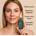 Ammuri’s 5% High Strength Retinol Serum + Apple Stem Cell Serum - 30ml - Ammuri Retinol Serum 5% (Ultimate Apple Stem Cell) - British D'sire
