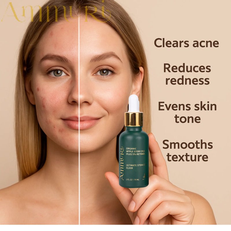 Ammuri’s 5% High Strength Retinol Serum + Apple Stem Cell Serum - 30ml - Ammuri Retinol Serum 5% (Ultimate Apple Stem Cell) - British D'sire
