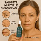Ammuri’s 5% High Strength Retinol Serum + Apple Stem Cell Serum - 30ml - Ammuri Retinol Serum 5% (Ultimate Apple Stem Cell) - British D'sire
