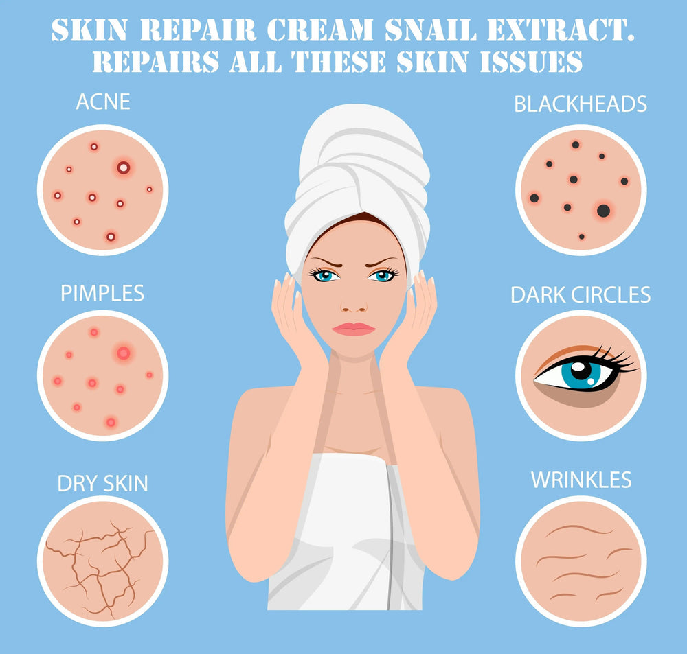 Ammuri Bioactive Snail Repair Cream showcasing benefits for acne, dry skin, and wrinkles. Ideal anti-aging snail cream.