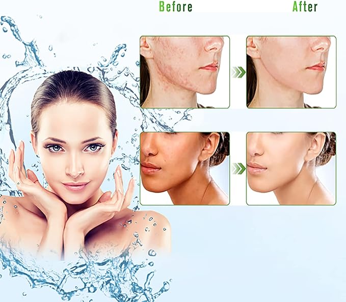 ASYBO 300 ML Aloe Vera Gel – 99% Organic Pure Aloe Vera Hydrating Moisturizer, Natural Aloe Cream for Dry Skin, Sunburn, Acne - British D'sire