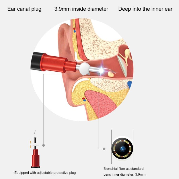 Bebird B1 Intelligent HD Visual Ear Cleaner Earwax Tool, Standard Version(Rose Gold) - British D'sire