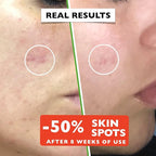 Big 2.11oz. Organic Vitamin C Serum for Face with Hyaluronic Acid. Anti-Aging, Wrinkles, Dark Spots, Brightening and Vegan. Facial Skin Care. Eye Cream Suitable. Women and Men - British D'sire