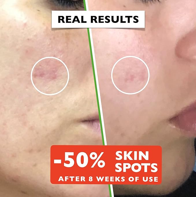 Big 2.11oz. Organic Vitamin C Serum for Face with Hyaluronic Acid. Anti-Aging, Wrinkles, Dark Spots, Brightening and Vegan. Facial Skin Care. Eye Cream Suitable. Women and Men - British D'sire