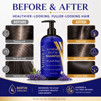 Biotin DHT Blocker Shampoo | Hair Growth & Dandruff - Hair Loss Treatments - British D'sire