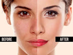 Extreme Whitening Cream For Dark Spots Blemishes Bikini Under Arms Skin Brightening Treatment - Vitamin C Cream - British D'sire