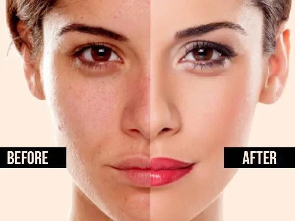Extreme Whitening Cream For Dark Spots Blemishes Bikini Under Arms Skin Brightening Treatment - Vitamin C Cream - British D'sire