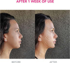 Foreo Bear Smart Microcurrent Face Lift Device | Face Sculptor & Jaw Excerciser | Immediately Visible Non-Invasive Face Lift | Antiaging | Safe & Painless | Fuchsia - Beauty Tools - British D'sire