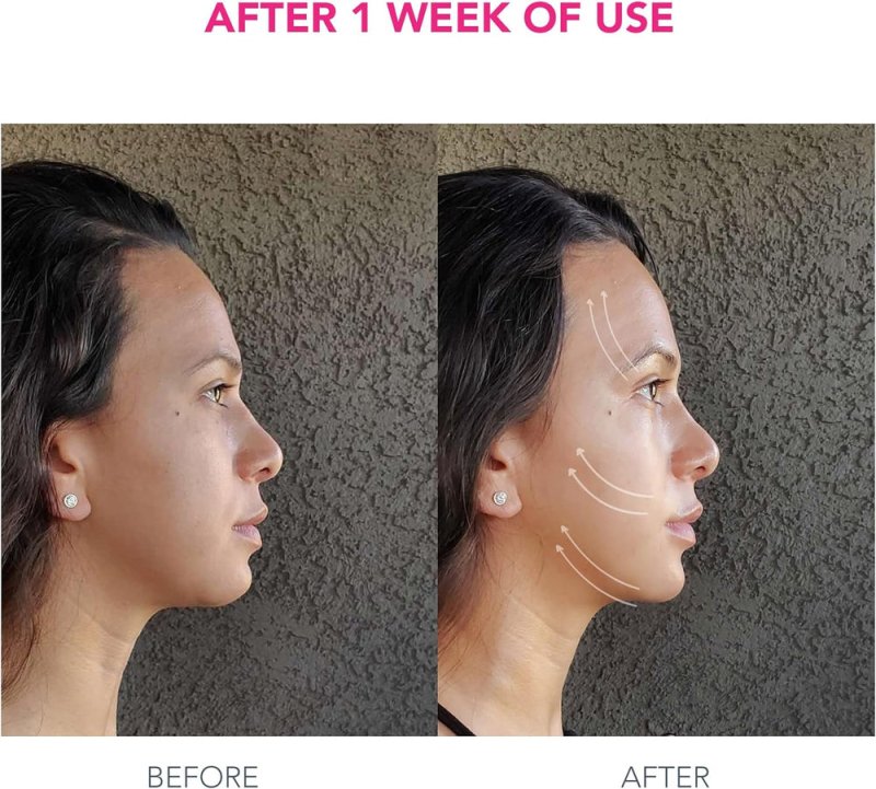 Foreo Bear Smart Microcurrent Face Lift Device | Face Sculptor & Jaw Excerciser | Immediately Visible Non-Invasive Face Lift | Antiaging | Safe & Painless | Fuchsia - Beauty Tools - British D'sire
