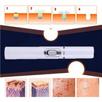 K - SKIN KD - 7910 Acne Laser Pen Portable Wrinkle Removal Machine Durable Soft Scar Remover Device Blue Light Therapy Pen - British D'sire