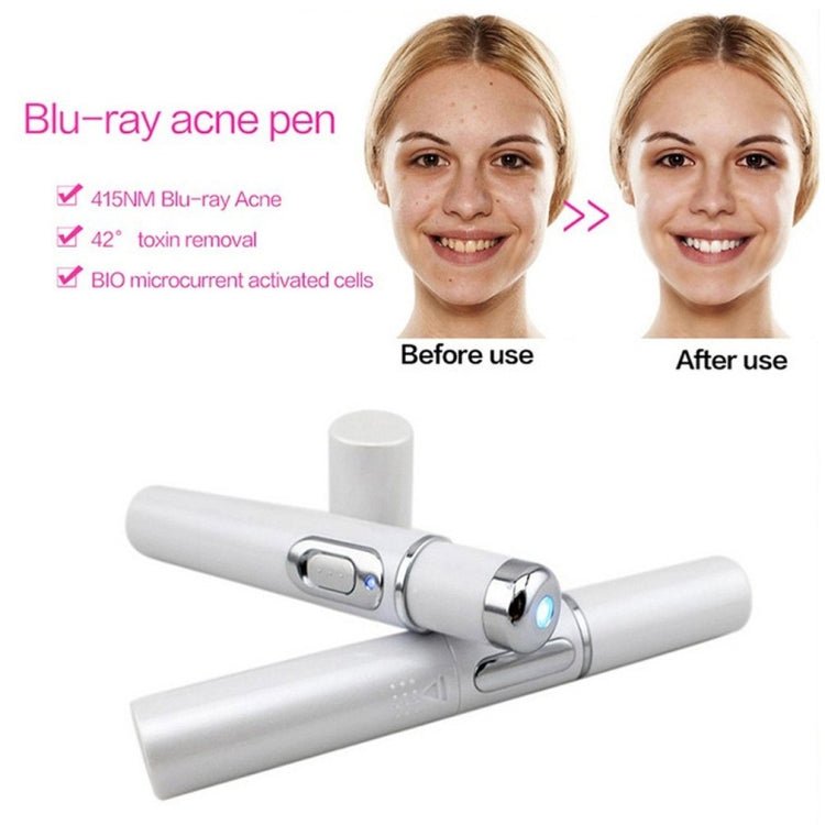 K - SKIN KD - 7910 Acne Laser Pen Portable Wrinkle Removal Machine Durable Soft Scar Remover Device Blue Light Therapy Pen - British D'sire