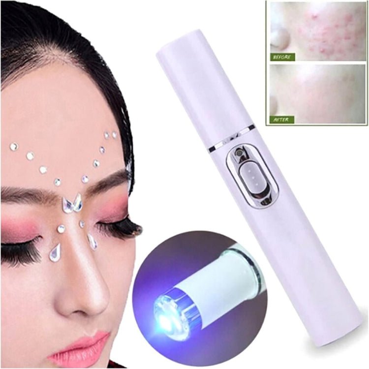 K - SKIN KD - 7910 Acne Laser Pen Portable Wrinkle Removal Machine Durable Soft Scar Remover Device Blue Light Therapy Pen - British D'sire