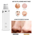 K - SKIN KD - 8023Ultrasonic Blackhead Acne Removal Pore Cleaner Facial Skin Care Scrubber Exfoliating Pore Cleaner - British D'sire