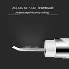 K - SKIN KD - 8023Ultrasonic Blackhead Acne Removal Pore Cleaner Facial Skin Care Scrubber Exfoliating Pore Cleaner - British D'sire