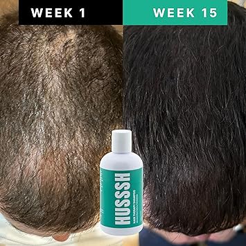 Madam Wellness NatureCare Sulfate - Free Natural Shampoo – 250ml Hair Thickening Treatment for Women & Men | Enriched with Argan Oil & Rosemary Extract | Promotes Hair Growth, Strengthens, and Restores Volume - Natural Shampoo - British D'sire