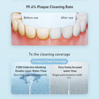 Original Xiaomi Mijia F300 Electric Pulse Oral Irrigator Tooth Cleaner, Capacity : 240mL (White) - British D'sire