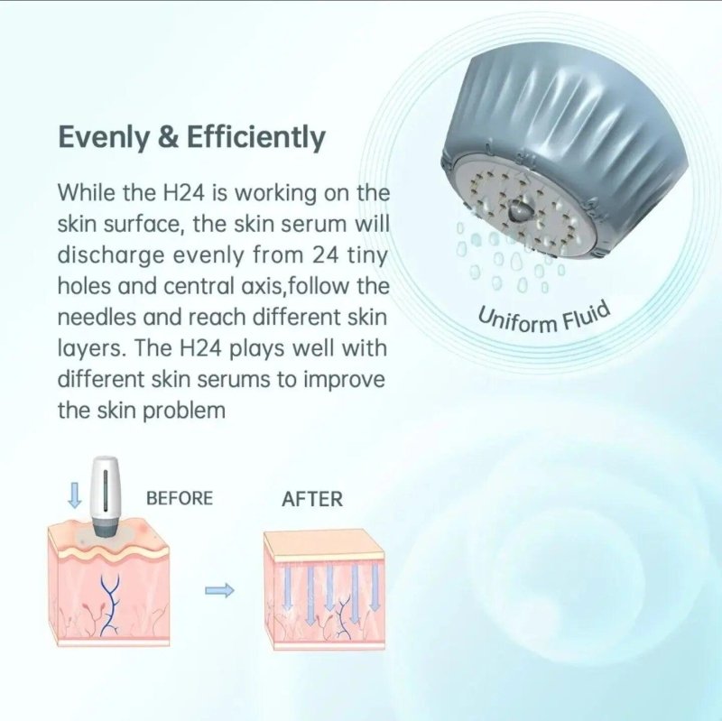 Professional Microneedling at Home 0 - 1.5mm Adjustable Derma Stamp - AESTHETIC DERMA ROLLER SYSTEM - British D'sire