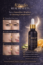 Retinol Serum Anti Age Vitamin C Hyaluronic Acid Serum Retinol Serum Cream Anti Wrinkle - Ammuri Pro - Retinol 2.5% Face Serum - British D'sire