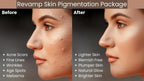 Revamp Skin Pigmentation Package 2 Skincare Gift Set - British D'sire