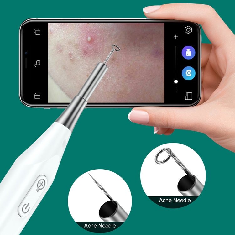 Supereyes Y009 Visual Ear Pick Acne Cleaning Microscopic Magnifying Mirror Endoscope - British D'sire