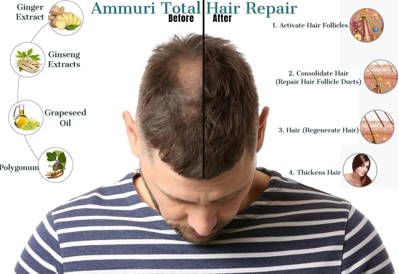 Total Hair Repair Growth Oil 100% Natural Target DHT Biotin Argan Oil, Hair Serum for Hair Growth - Hair Growth Serum - British D'sire