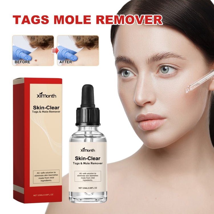 Ximonth 20ml/Bottle Anti Mole And Wart Liquid Dark Spot Tag Remover Skin Essence - British D'sire Main image