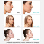 Xpreen Rechargeable Pore Cleanser Home Facial Beauty Device with LED Screen & 4 Probes - British D'sire